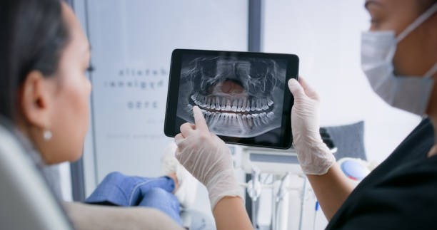 Licensed Tooth Extraction service in Orangeburg, SC - Smile Center Dentistry